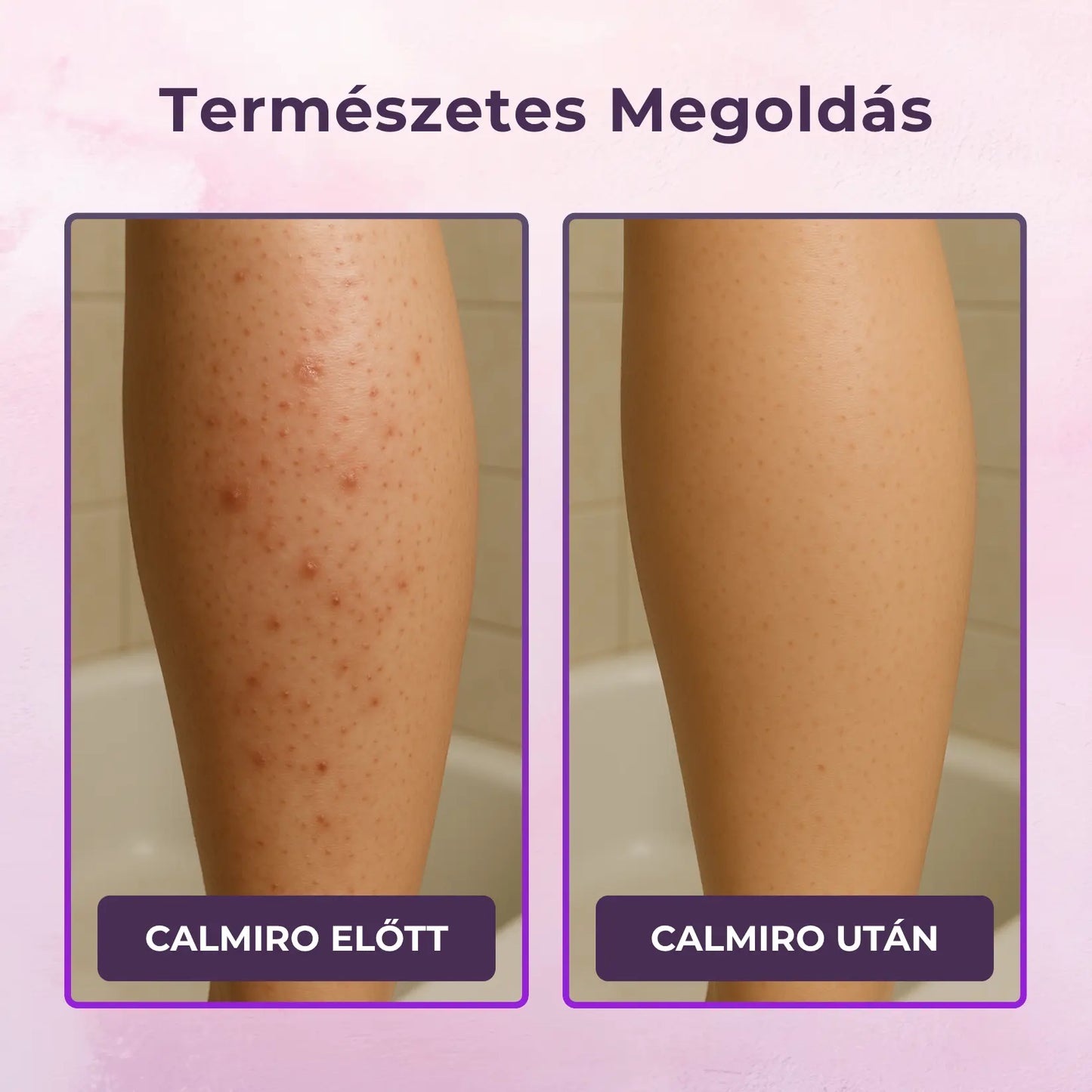 Calmiro™ Cyperus Elixír